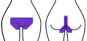 Diagram of what's removed during a brazilian wax at Hideaway Spa in Windsor